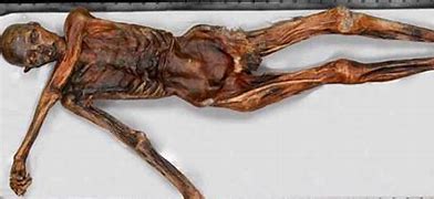 mummified body